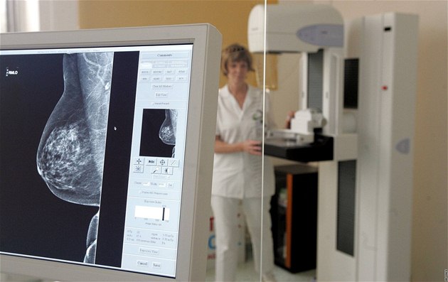 Málo léku s tamoxifenem na rakovinu prsu budou lékárny řešit přerozdělením balení