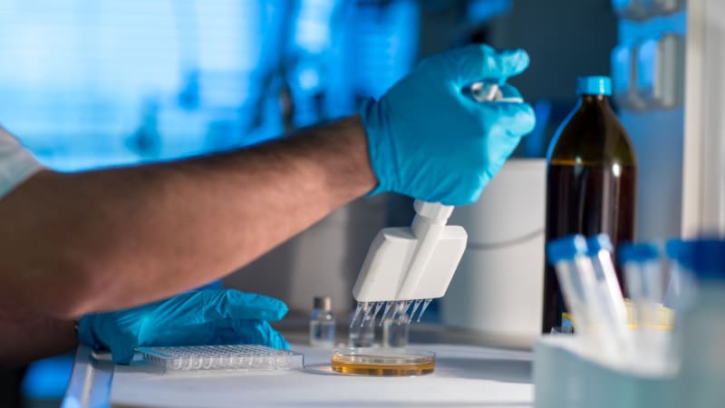 Evropou se šíří virus Shamonda. Ve Francii hlásí první úmrtí člověka